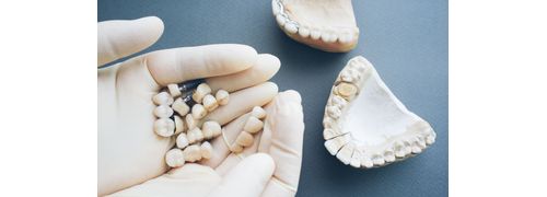 Aperfeiçoamento em Prótese Fixa