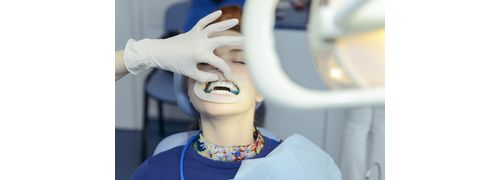 Aperfeiçoamento em Dentística Restauradora Estética - Teórico e Prático