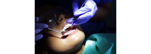 Aperfeiçoamento em Implantodontia: Fase Cirúrgica e Protética